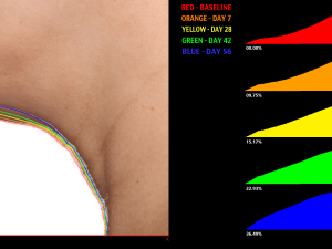 CMA03 neck analysis expanded