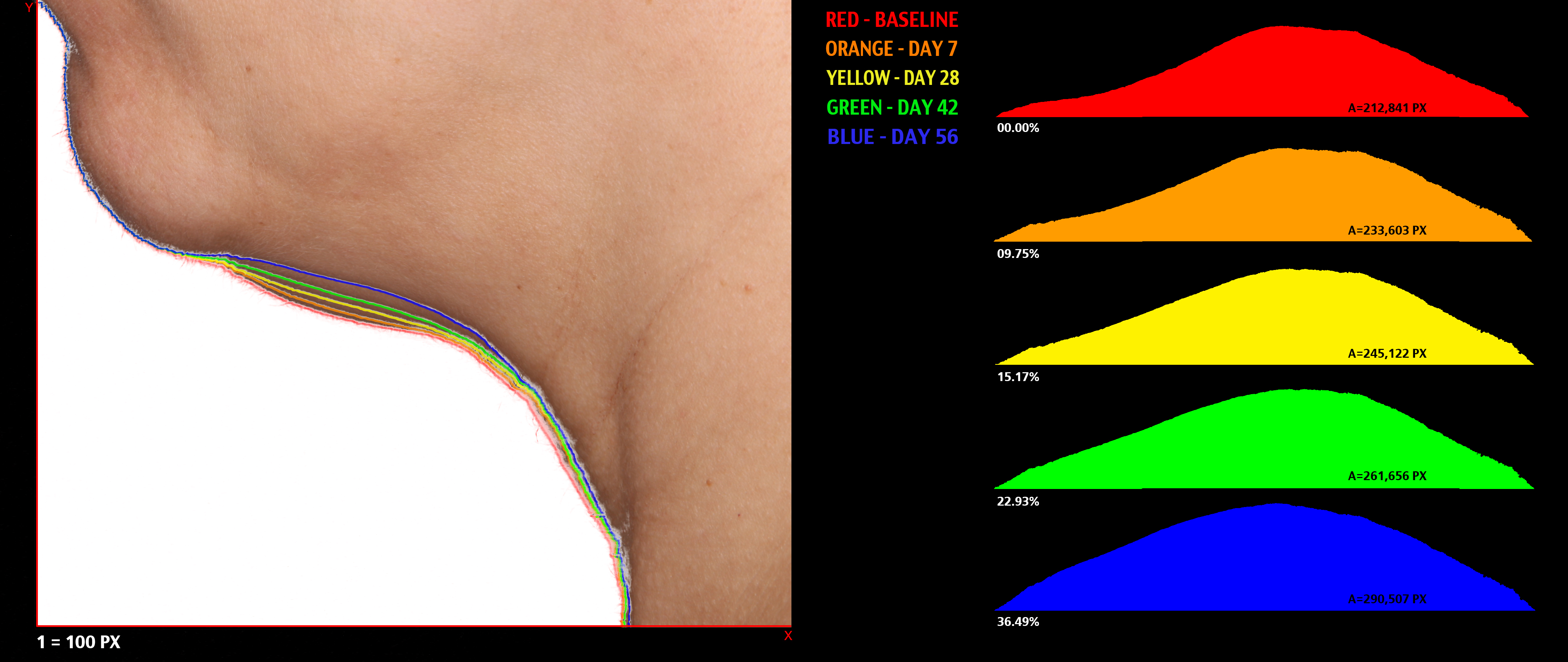 CMA03 neck analysis expanded