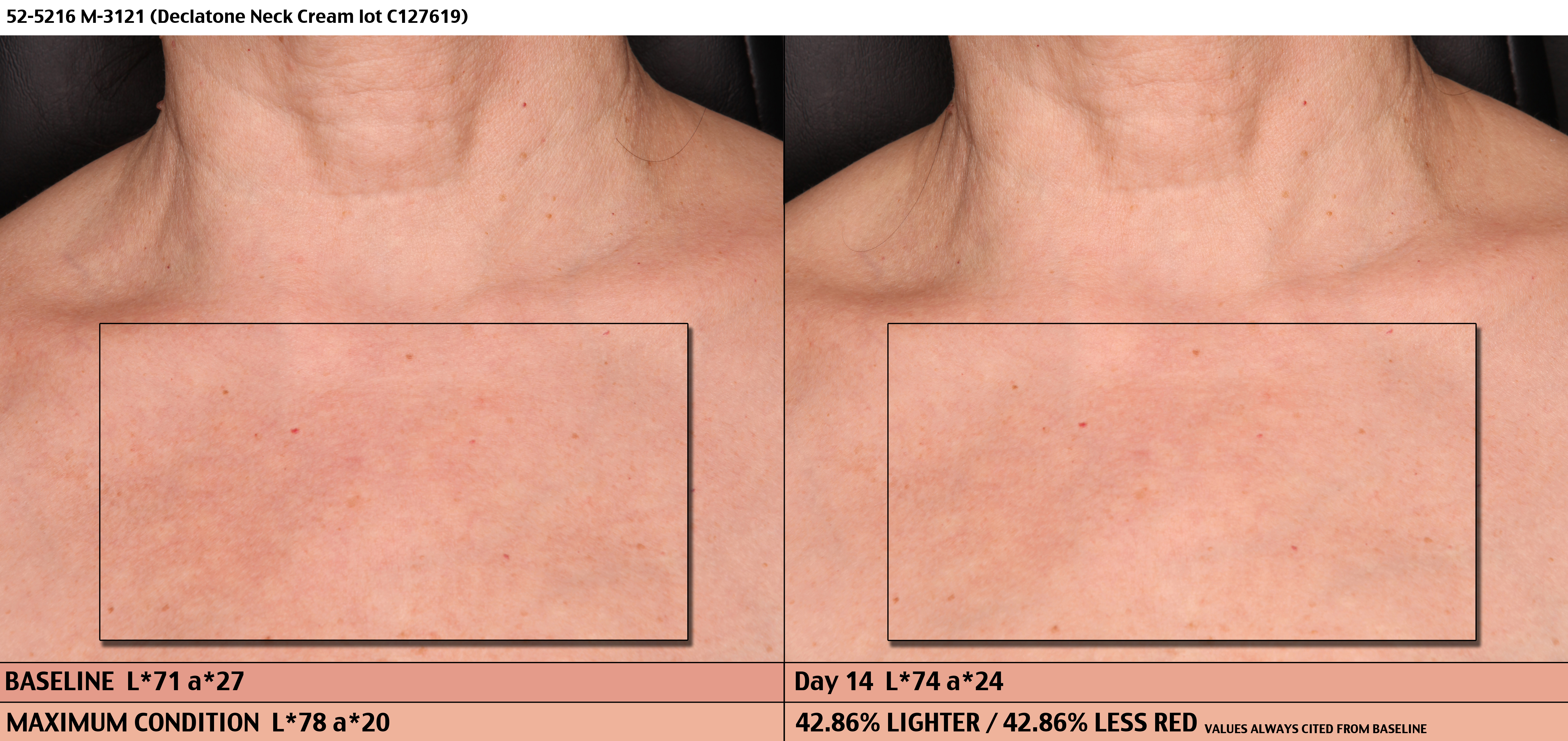 DEC01 Neck Cream Baseline, Day 14 PhGx