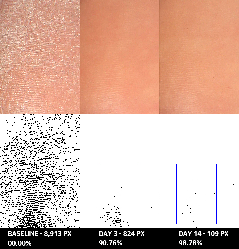 FEE04 Baseline, day 3, 7 PhGx