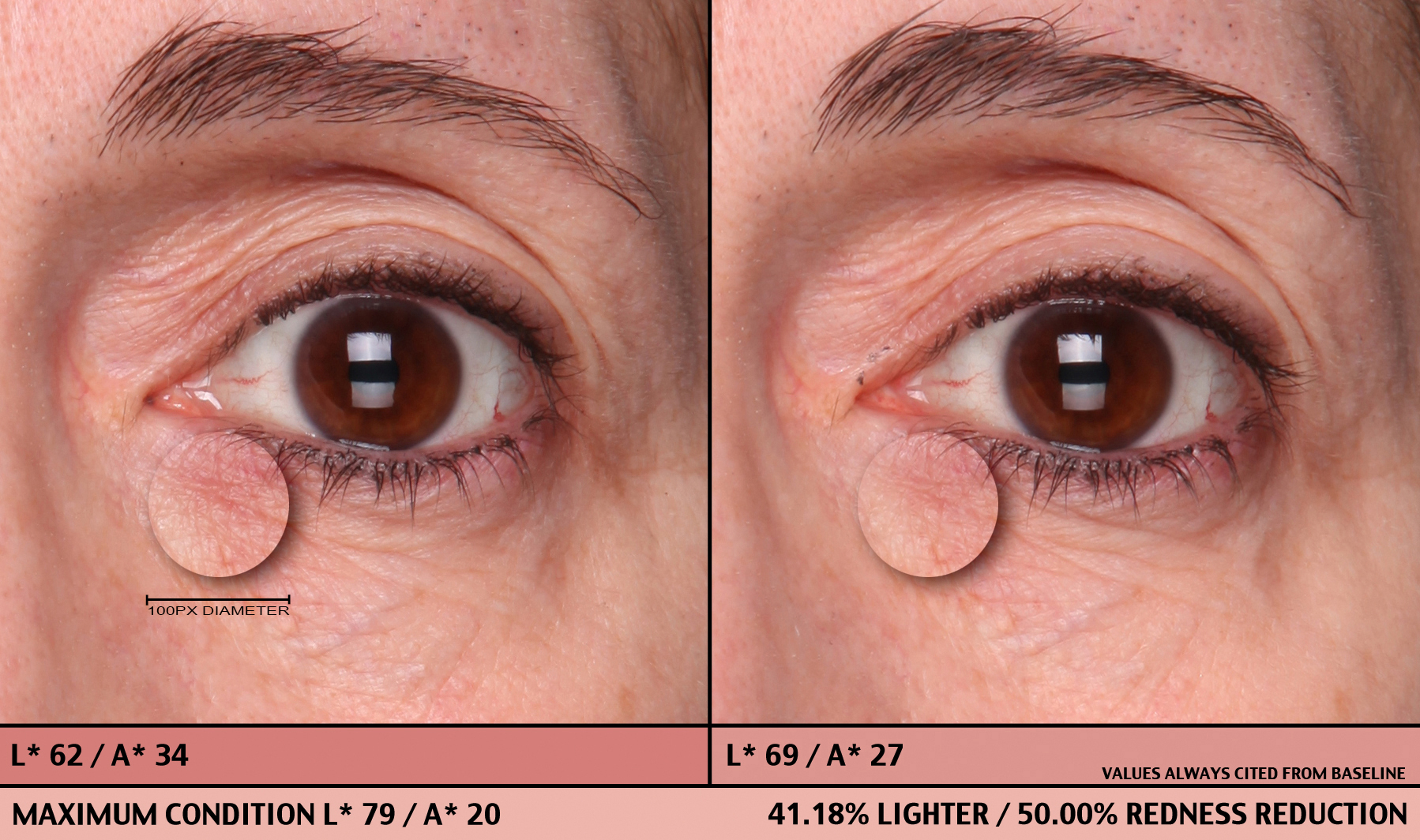 UND08 64-5026 Baseline, 10 Min Right Eye Color PhGx